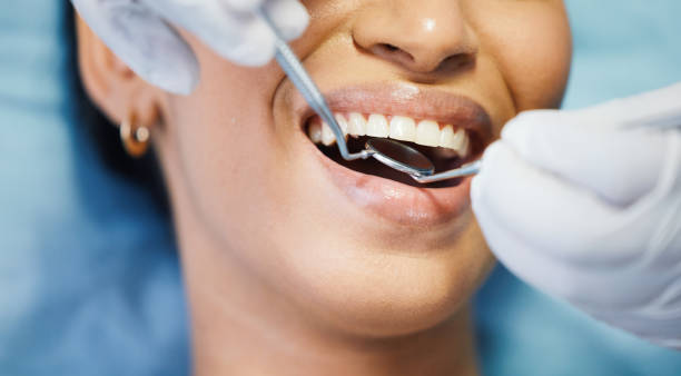 Best Broken or Chipped Tooth Repair in Reidland, KY