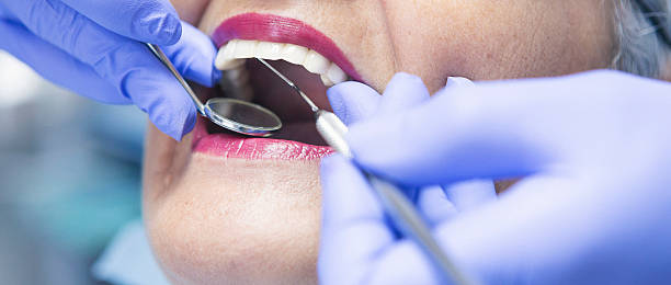Best Dental Abscess Treatment in Reidland, KY